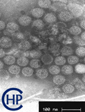 Rotavirus (EM photo)  